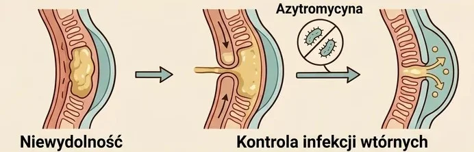 Ilustracja do artykułu